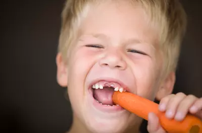 close up of kid missing two front teeth and eating a carrot